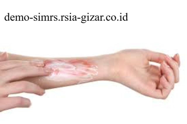 Jaringan Epidermis Mempercepat Regenerasi Sel Kulit Guna Mengatasi Efek Luka Bakar
