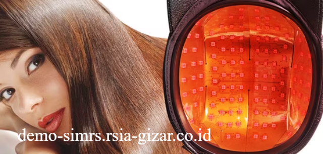 Keajaiban Topi Laser Solusi Modern Atasi Kebotakan Melalui Stimulasi Cahaya Merah